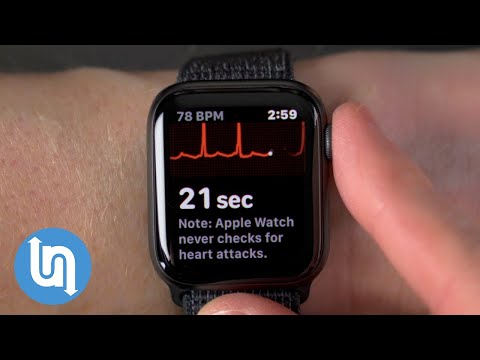 Apple Watch and the future of wearable technology in healthcare